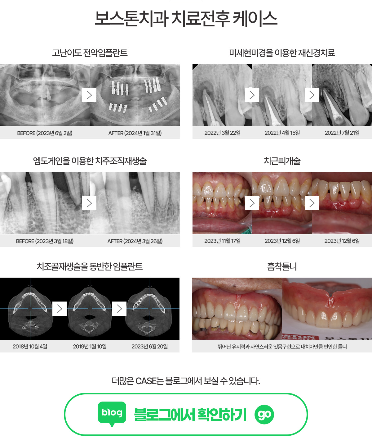 치료전후