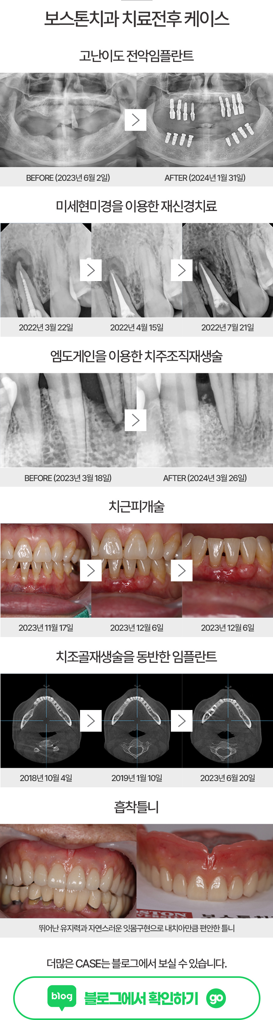 치료전후